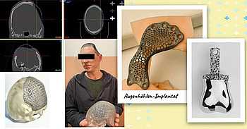 Bilder von Implantaten für Verwundete